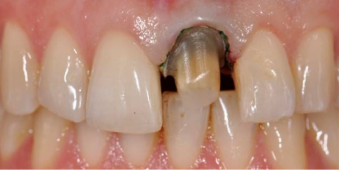 Before image